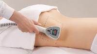 Ošetření - neinvazivní liposukce přístrojem Exilis