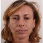 Facelift obličeje