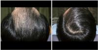 Dermaheal Sterm C´rum HL